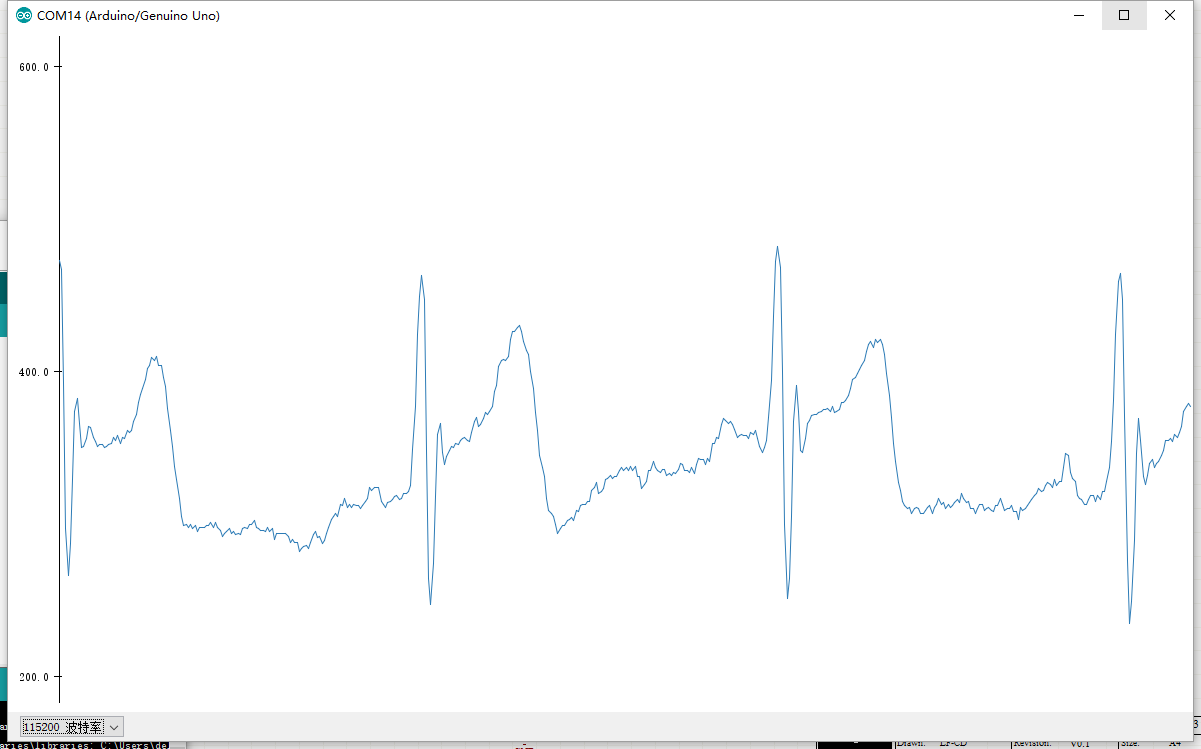 Arduino单导联心电检测传感器heart rate monitor